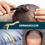 Elit Pharma Titanyum Dermaroller 1mm 540 Mikro İğne - Görsel 3