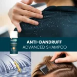 HairMD Clinical Güçlendirici ve Kepeğe Karşı Etkili Gelişmiş Şampuan 100 ml - Görsel 4